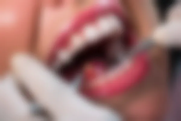 赣州贝壳口腔门诊部价格透明，服务优质，口碑如何？当地人推荐的牙齿美白选择！