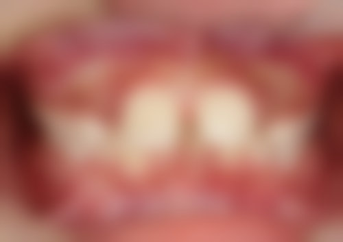 茀莱堡口腔医院患者好评汇总