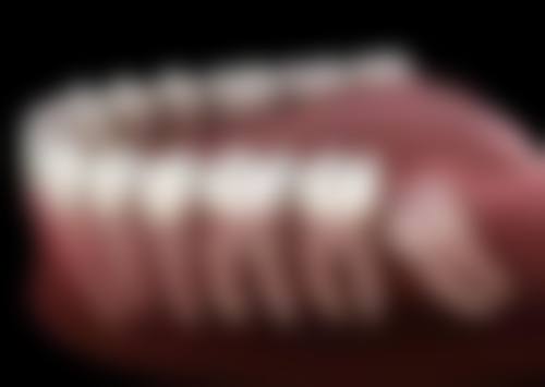 六、美学修复&牙周基础治疗费用参考