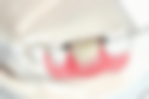 西安中诺口腔医院全口种植牙价格36000元起，中诺技术靠谱收费透明