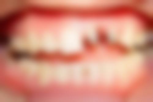 三、华忠口腔医院核心科室与特色项目