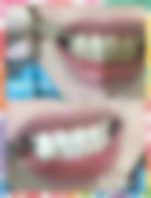 五、深圳李镇坤口腔诊所舒适就医环境，打造人性化诊疗体验