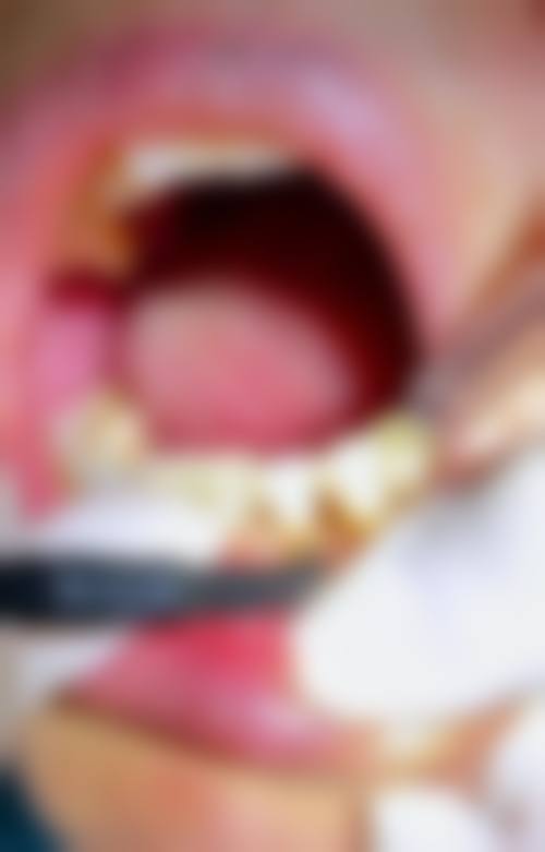 七、龙岩宝佳口腔门诊部就医指南，便捷就诊不迷路