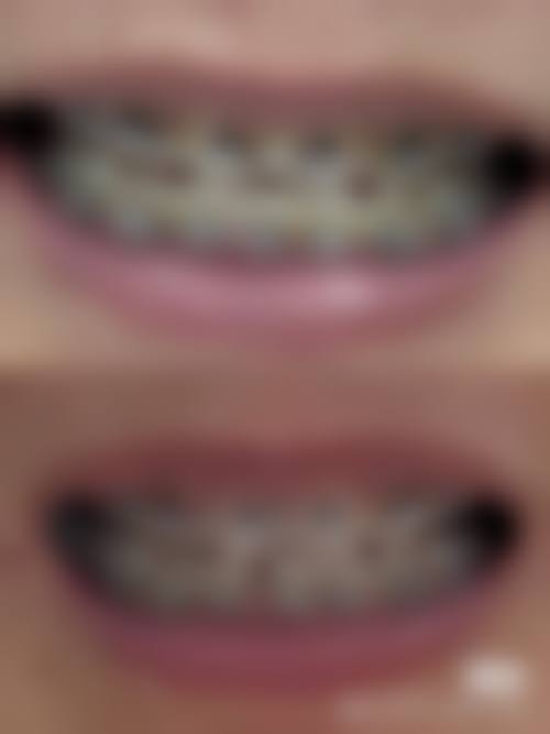 四、重庆市开州区人民医院口腔颌面外科设备介绍