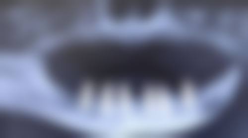 二、赤峰松山医院口腔科医生团队,打造专精诊疗服务