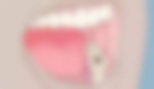 七、武汉蓝刺猬口腔门诊部就医指南,便捷就诊不迷路