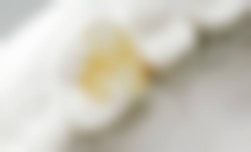 七、温州永嘉肖尔口腔就医指南，便捷就诊不迷路