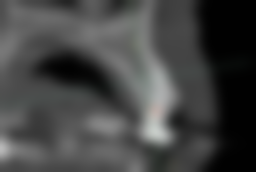 七、广州市花都区浩雅口腔诊所就医指南，便捷就诊不迷路