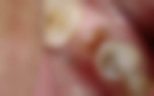 七、重庆泽美口腔医院就医指南,便捷就诊不迷路