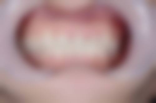 四、江苏徐州沛县新城嘉苑韩氏口腔设备介绍