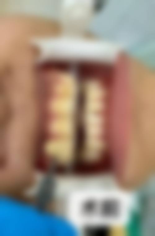 四、深圳童美齿科·童贝佳门诊部(侨香店)设备介绍