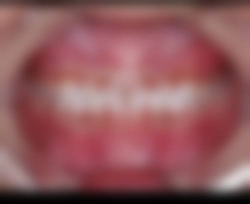 七、浙江温州永嘉吴元丽口腔就医指南，便捷就诊不迷路