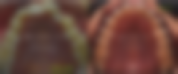 三、郑州卓越口腔医院核心科室与特色项目