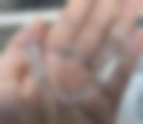 固定矫治的优缺点分析