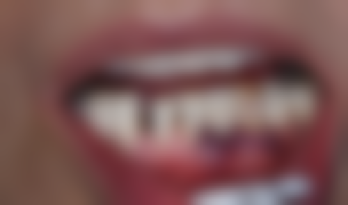 三、江苏南通启东皓齿口腔核心科室与特色项目