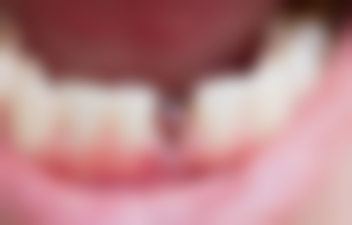 五、江苏南通启东皓齿口腔舒适就医环境，打造人性化诊疗体验