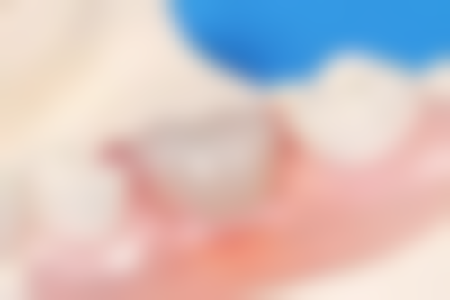 四、嘉兴海宁安圣凯口腔设备介绍