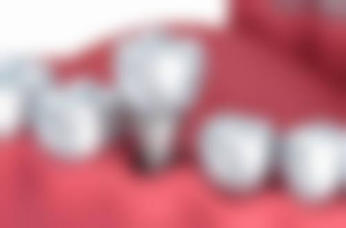 二、宁波牙医帮口腔医生团队，打造专精诊疗服务