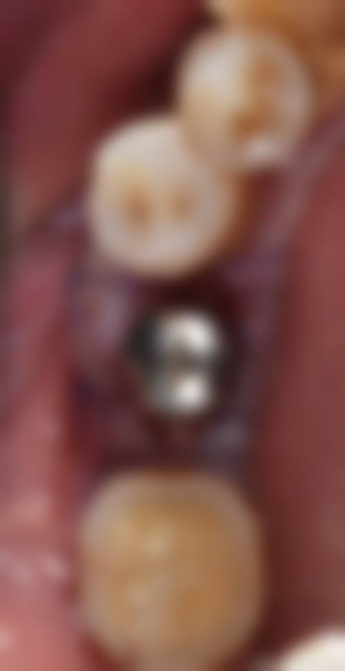 二、广东惠州博罗文彬口腔诊所医生团队，打造专精诊疗服务