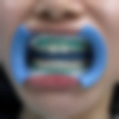 七、江苏泰州玲之珑口腔就医指南，便捷就诊不迷路