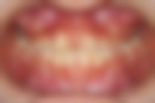 七、内蒙古赤峰忠冠口腔就医指南,便捷就诊不迷路