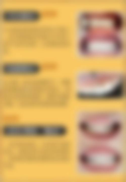 二、广东广州钟兴口腔医生团队，打造专精诊疗服务