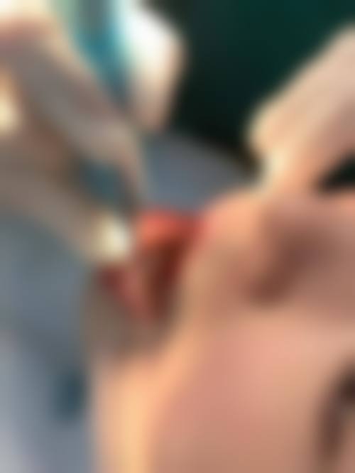 二、韩国艾恩（iron）整形医院医生团队，打造专精诊疗服务