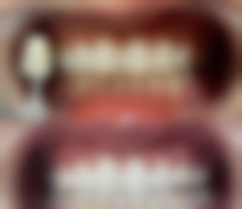 四、韩国艾恩（iron）整形医院设备介绍