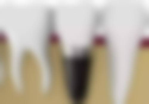 七、内蒙古巴彦淖尔春江口腔诊所就医指南,便捷就诊不迷路