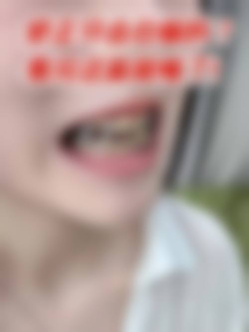 四、天水李亚洲口腔设备介绍