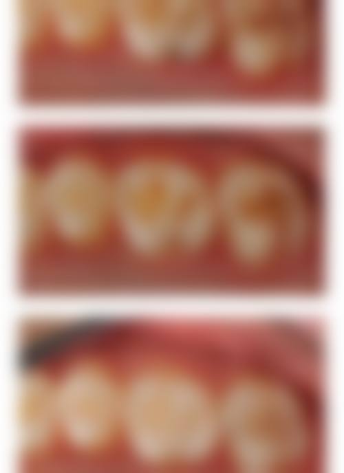 七、内蒙古赤峰毕兰兰众合口腔门诊部就医指南，便捷就诊不迷路