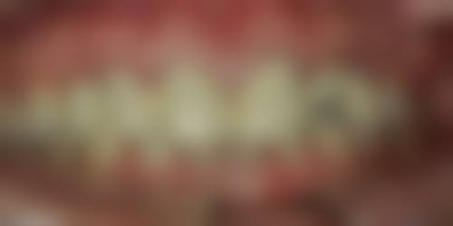 四、佛山市口腔医院口腔修复科设备介绍