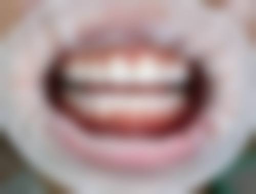 二、佛山市口腔医院口腔修复科医生团队,打造专精诊疗服务