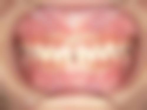 七、东莞致上口腔(寮步分店)就医指南,便捷就诊不迷路