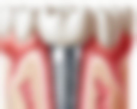 二、广东清远康乃馨口腔医生团队，打造专精诊疗服务