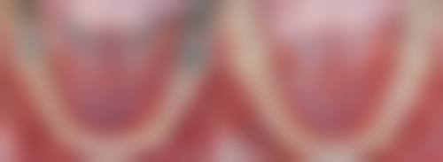 四、芜湖东门口腔设备介绍