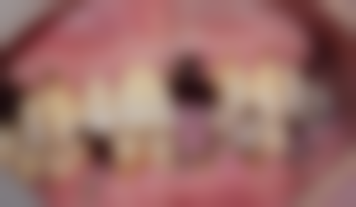 四、永州龙山口腔设备介绍