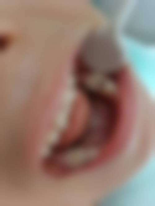 二、甘肃省人民医院口腔修复科医生团队，打造专精诊疗服务