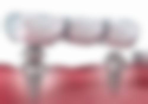 四、连云港灌云艾尚美口腔门诊部设备介绍