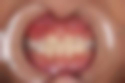 七、上海优齿佳口腔就医指南,便捷就诊不迷路