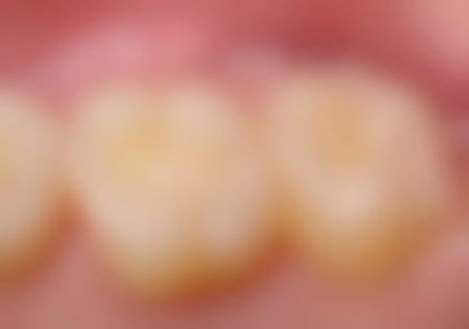 六、山东济南历下博瑞特口腔荣誉资质与患者口碑,见证品牌实力