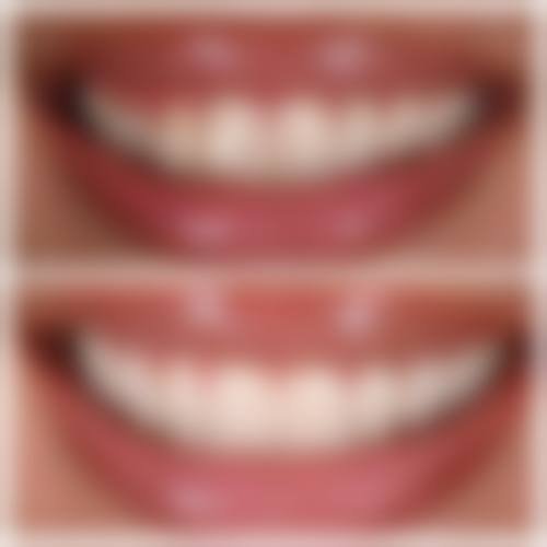 三、泰州全优星口腔门诊核心科室与特色项目