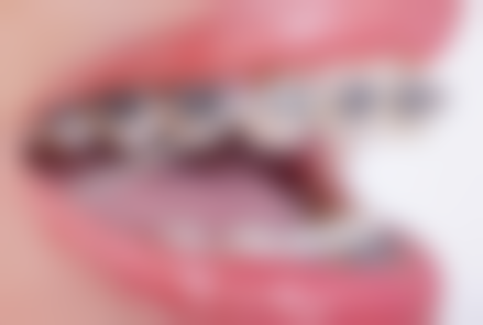 三、金华市永康胡莹莹口腔核心科室与特色项目