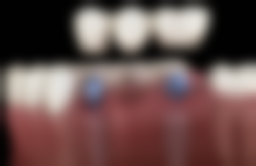 七、盐城倍美口腔门诊部(南金鹰店)就医指南,便捷就诊不迷路