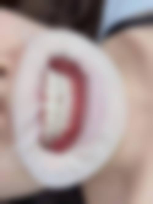 五、昆山青穗植发舒适就医环境，打造人性化诊疗体验