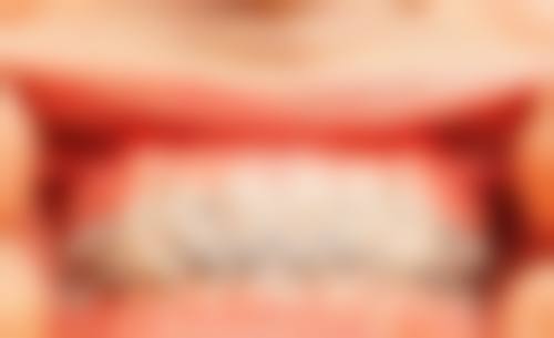 四、深圳一芽口腔诊所设备介绍