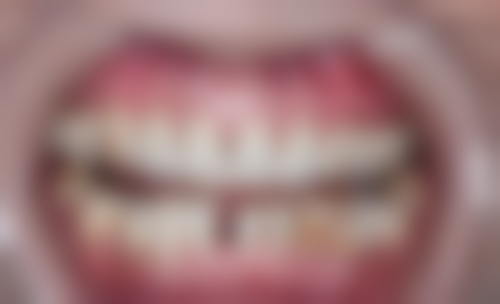 六、涪陵佳欣口腔医院荣誉资质与患者口碑,见证品牌实力