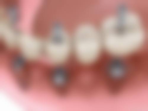 二、乌海伯瓷口腔医院医生团队，打造专精诊疗服务