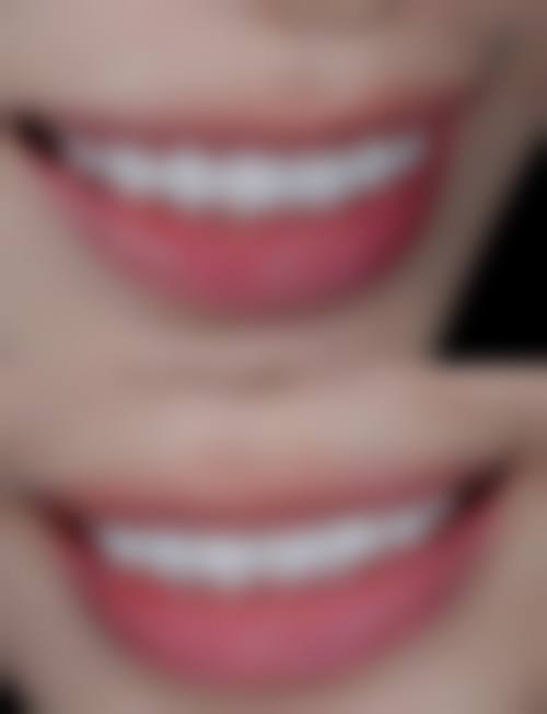 四、中山碧莲盛植发设备介绍