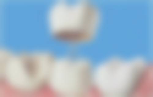 三、深圳博耀齿科(翠竹分院)核心科室与特色项目